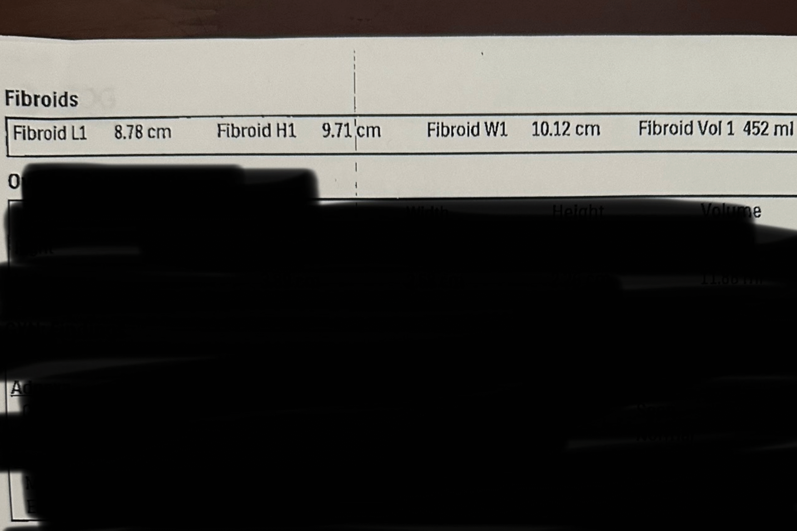 fibroids.png